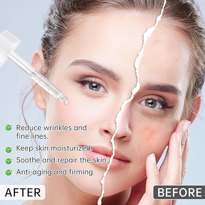 Anti Aging Argireline Solution 10%,Anti Wrinkle Hydrating Argireline Serum with Centella & Hyaluronic Acid for Skin Barrier Repair,30ml Peptides Serum for Face Reduce Fine Lines