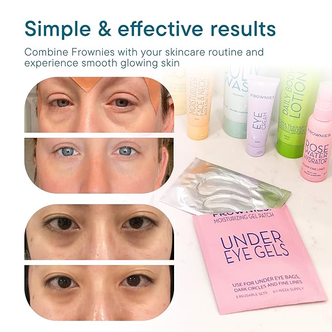 Frownies Under Eye Gel Patches for Puffy Eyes - Dark Circles with Cactus Collagen - Reusable, 3 Pack