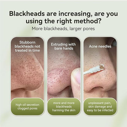LANBENA 2.0 Blackhead Remover - 60 Pieces Peel Off Mask for Nose & Face, Nose Plants Pore Strips with Salicylic Acid, Blackhead Removal Kit 1.05oz