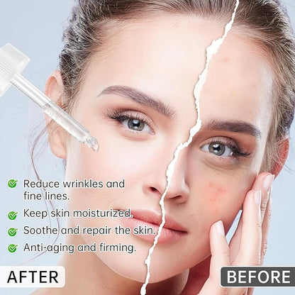 Anti Aging Argireline Solution 10%,Anti Wrinkle Hydrating Argireline Serum with Centella & Hyaluronic Acid for Skin Barrier Repair,30ml Peptides Serum for Face Reduce Fine Lines